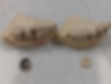 PFM crowns next to Porcelain crowns