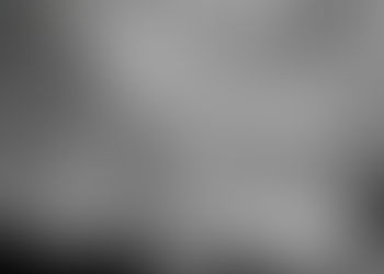 Wisdom Teeth Xray - Gallery