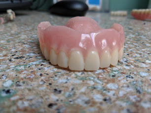 How Long Can I Leave My Immediate Dentures Out