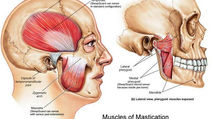 TMJ Headache Guide