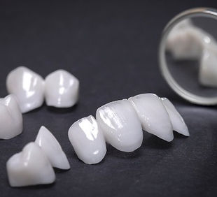 Dental Veneers