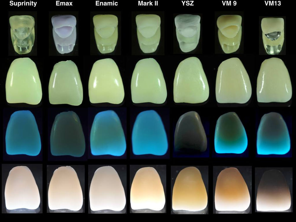 Do Veneers Glow In Blacklight?