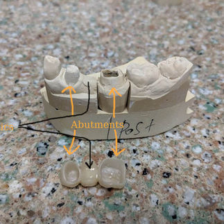 labeled bridge components on model