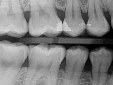 Checklist For What To Bring To Dentist Appointment