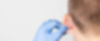 otoplasty-masthead.jpeg