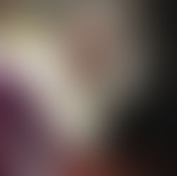 ന്യുമോണിയക്ക് പുറമെ മാർപാപ്പക്ക് വൃക്കയിലും തകരാർ