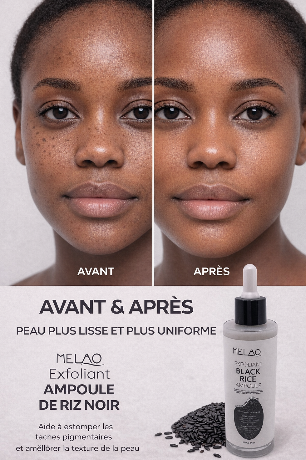 Miniature : AVANT APRÈS: femme peau plus lisse et uniforme, Sérum exfoliant au riz noir.