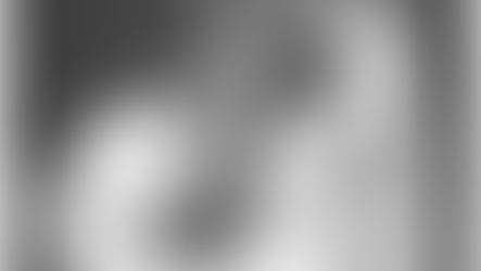 A tonsillectomy in the 1930s