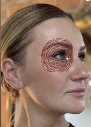 Mid Face Anatomy with Lamija Hubjer, PA-C