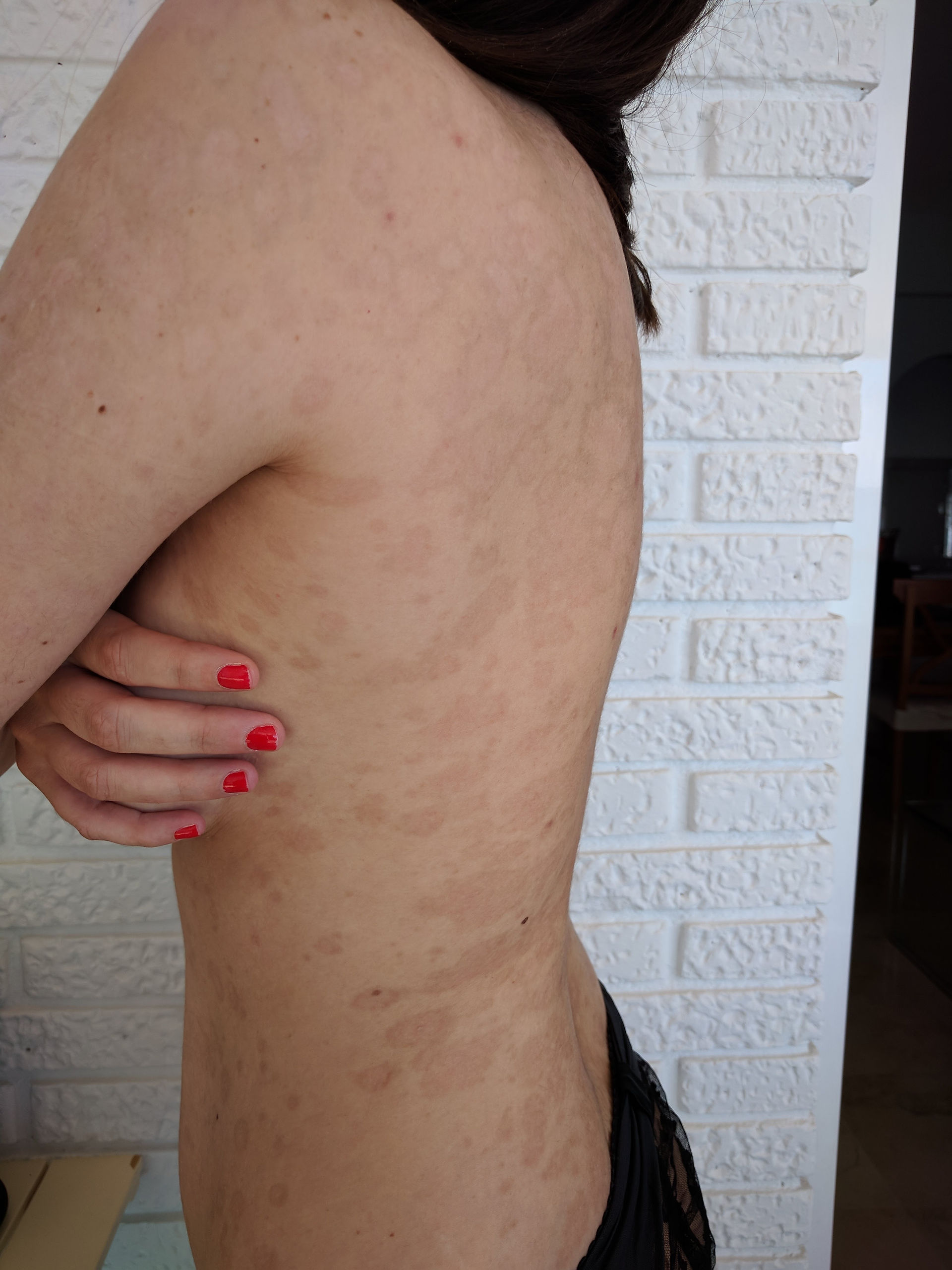10 mois après mon hospitalisation