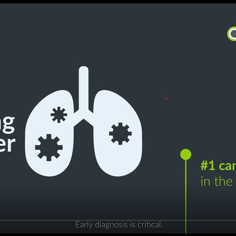 Optellum, AI Lung Cancer Diagnosis Innovator, Secures $14M Series A Funding