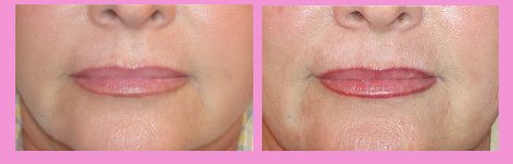 Permanent Make-up