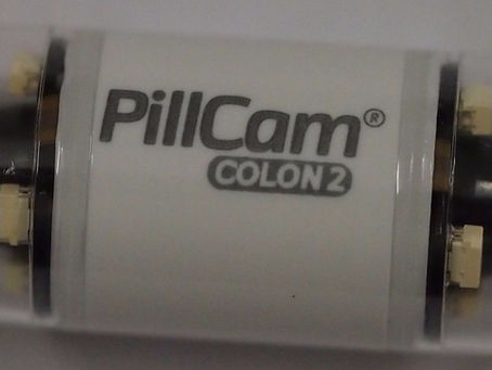 Swallow the camera to view the inside of your gut.