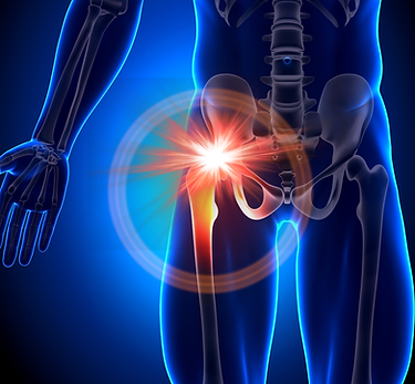 Medical illustration showing persistent hip pain and inflammation despite rehabilitation and physical therapy treatment