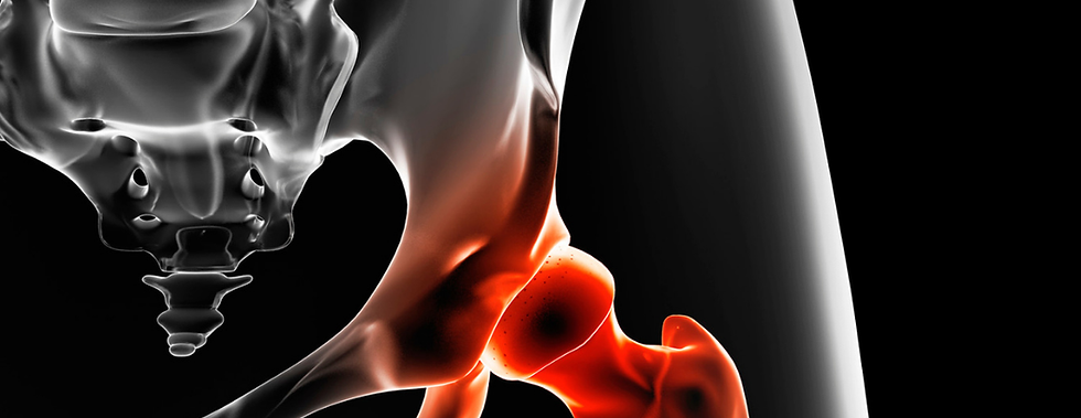 Illustration of a person experiencing hip pain with the hip joint highlighted, representing persistent pain despite normal X-ray findings.