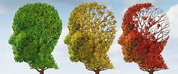          Alzheimer's and the warning signs you must know