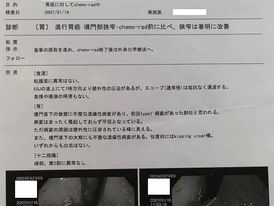 胃内視鏡検査
進行胃がん
胃がん
アラビノキシラン
オリザロース
superAFTM