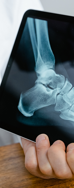 leg x-ray