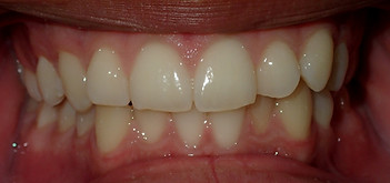 MO444-Initial-13.jpg