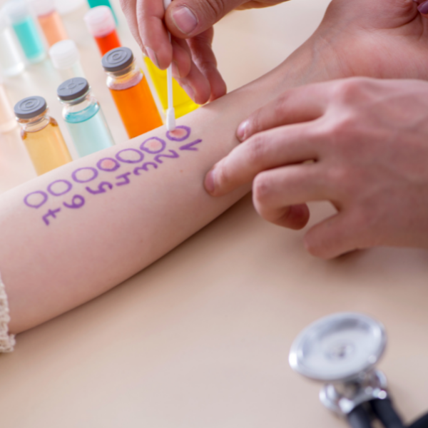 allergie e intolleranze diagnosi