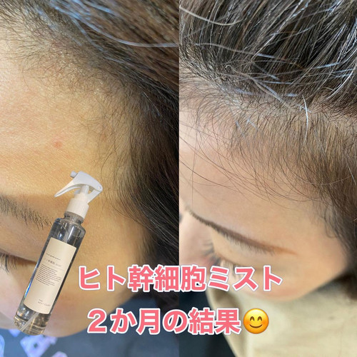 ヒト幹細胞ミスト 4本セット 楽天市場】ニーゲンキ ミスト ヒト幹細胞ミスト 全身使える 培養