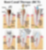 280215025151RCT.png