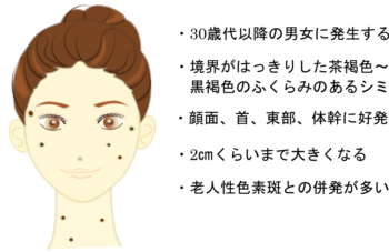 K-clinic-脂漏性角化症 説明-e1499645308105.png