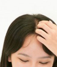 中文 薄毛治療 Kclinic