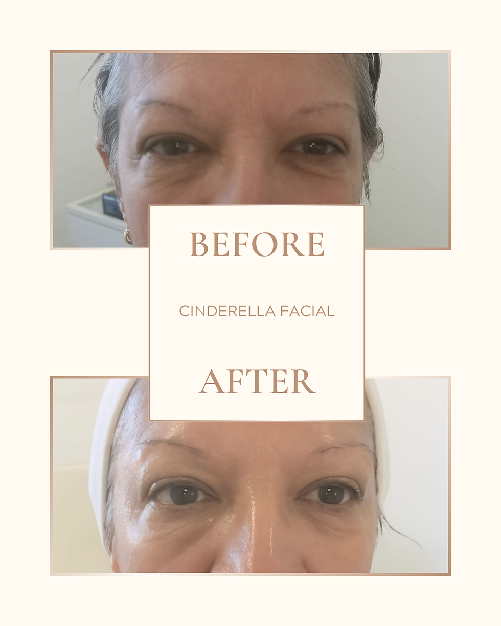 The before and after of a Cinderella Luxe facial - the changes are immediate and very effective. Perfect for big occasions when you want to look and feel your best.