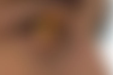 A Guide to Ketamine Assisted Psychotherapy: What to Know and What to Expect