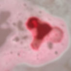 Thumbnail: Abortion is for Everyone Bath Bomb Set