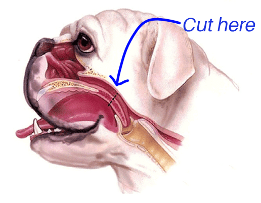 diagram of incision for elongated soft palate surgery