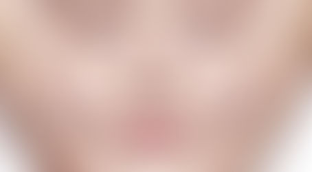 FACELIFT DE ACCESS: Más que rejuvenecer tu rostro, es liberar tu ser.✨