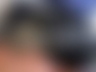 Bagian tubuh yang menghitam ketika terkena pes membuat penyakit ini disebut Black Death pada abad ke-14 di Eropa.