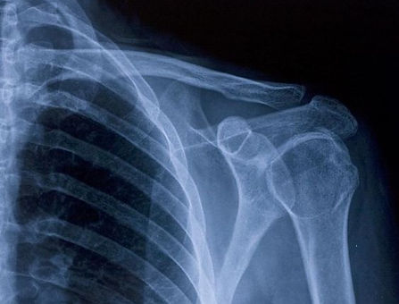 xray.jpg