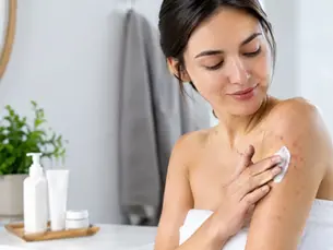 How to Treat Body Acne Without Damaging Skin