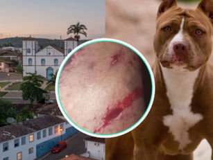 Mulher é atacada por dois pitbulls em Pirenópolis; moradores evitam tragédia