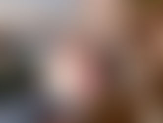 Mulher é atacada por dois pitbulls em Pirenópolis; moradores evitam tragédia