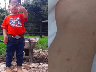 Criança é picada por cobra na porta da em fazenda em Itaberaí