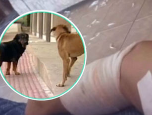 Moradora é atacada por três cães na Vila Colombo e sofre múltiplas mordidas