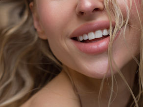 The Most Kysse-able Lips  