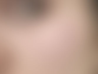 Microdermal - co czyni go wyjątkowym?