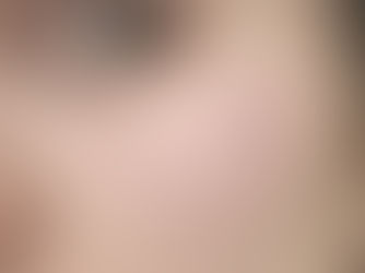 Microdermal - co czyni go wyjątkowym?