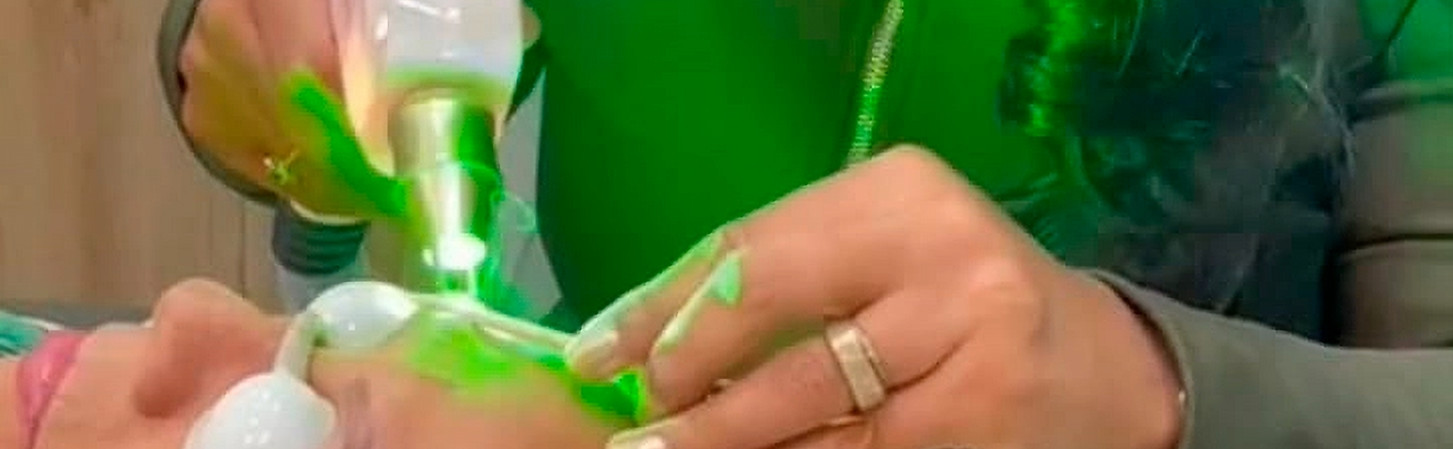 esteticista removendo micro a laser