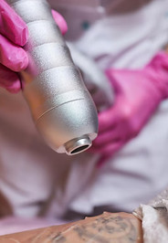 jovem-passando-por-procedimento-de-remocao-de-tatuagem-a-laser-em-close-do-salao_152904-17