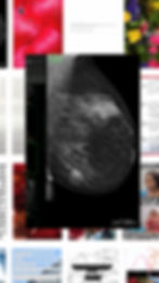 Thumbnail: sick titties zine pack