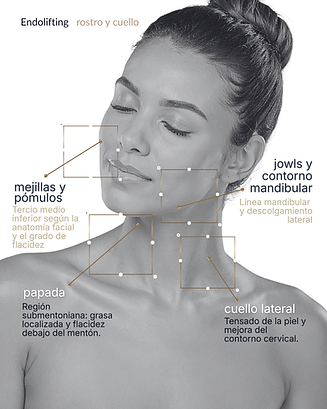 endolifting-dr-iignacio-camiña.png
