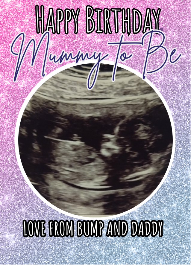 Thumbnail: Love from Bump (Add Own Baby Scan / Photo)