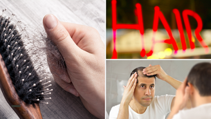 ผมร่วง ผมบาง จากอายุที่เพิ่มขึ้น