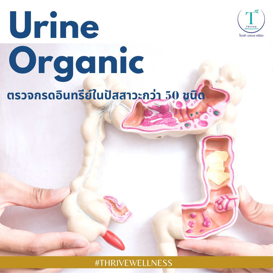 Urine Organic test.png